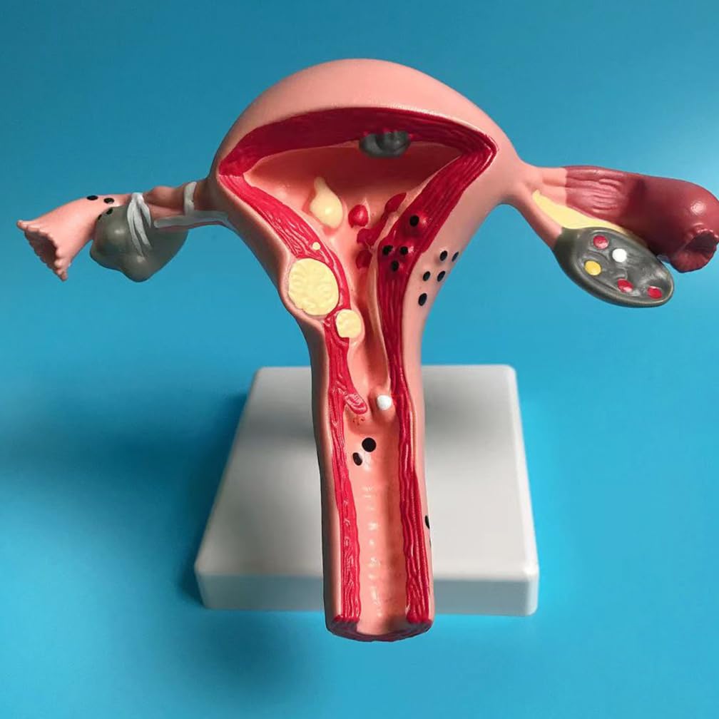 1pc Human Pathological Uterus Ovary Model Cross Section Structure Model Uterus Anatomical Anatomy Female Organ Teach Study Tool