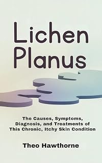 Lichen Planus : The Causes, Symptoms, Diagnosis, and Treatments of This Chronic, Itchy Skin Condition