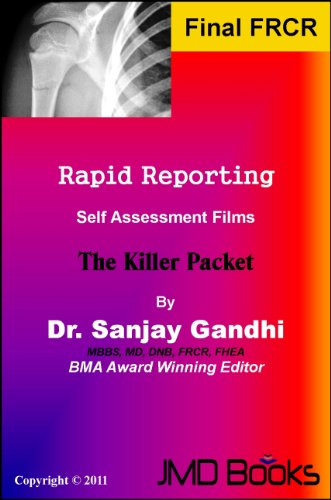 Rapid Reporting ‘The Killer Packets’ (Rapid Reporting Series)