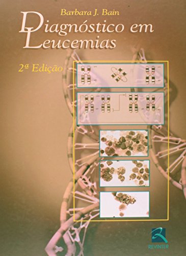 Diagnostico Em Leucemias