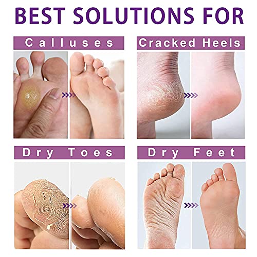 Foot Peel Mask 3 Pack, Exfoliating Foot Socks Calluses Remover Dead Skin, Moisturizing Feet Peeling Mask for Dry Skin… - Afbeelding 5
