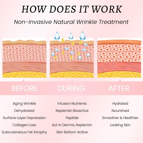 image for Kaely Wrinkle Patches for Face Overnight, Silicone Scar Tape for Wrink