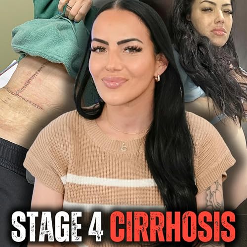 Throwing Up Blood & Still Drinking | Stage 4 Cirrhosis, Liver Transplant & 19 Months Sober