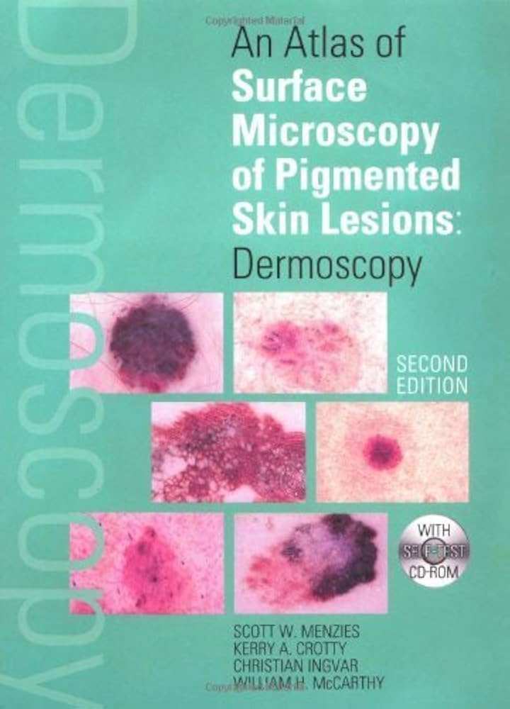 ダーモスコピーのすべて 第二版= TEXTBOOK OF DERMOSCOPY Atlas of Dermoscopy: Third Edition: 9781138595989: Medicine