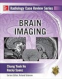 Radiology Case Review Series: Brain Imaging