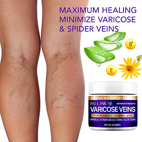 Paulinrise Varicose Vein Cream For Legs thumb #2