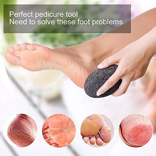 PETSUPS Natural Pumice Stones for Feet, Premium Exfoliator & Foot File,Foot File Callus Remover Foot Cracked Heels,Dead Skin,Hard Skin - Image 3