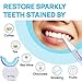 Whitebite Pro Teeth Whitening Kit with Pens: 32X LED Light with Hydrogen Carbamide Peroxide for Sensitive Teeth - Fast Teeth Whitener and Tooth Stain Remover for a Bright Smile