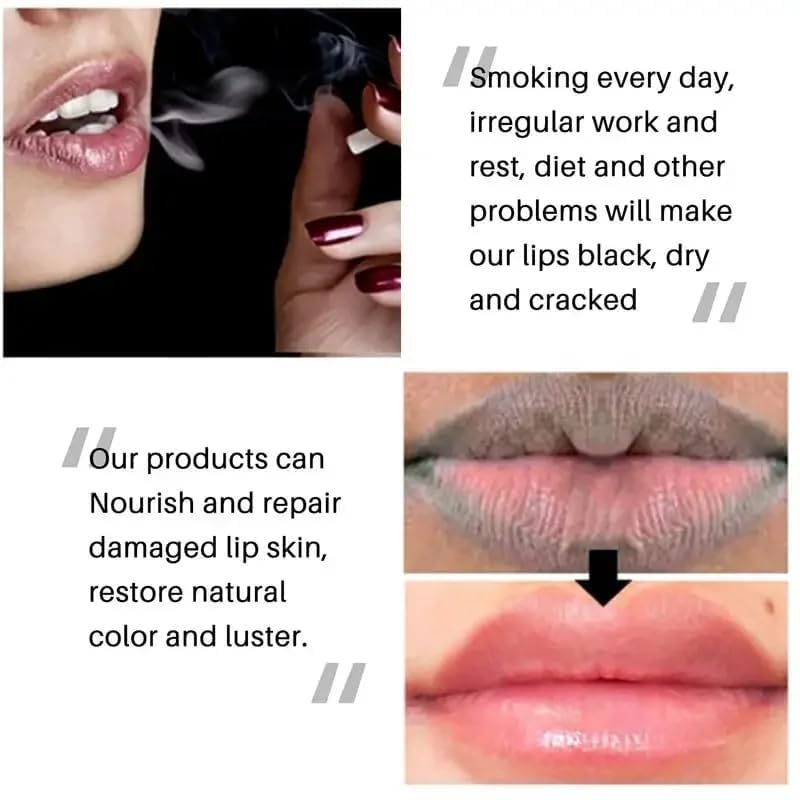 Generic Lip Lightening Lip Balm for Dark Lips – Lip Softening & Hydration,Help Fade Dark Lip Discoloration, Moisturizing Lip Balm for Smokers,Reduces Discoloration & Fine Lines,for Men And Women