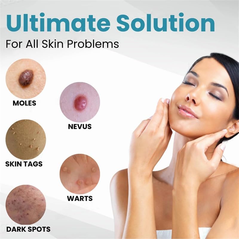 Visual representation of various skin problems the product can address: moles, nevus, skin tags, warts, and dark spots.