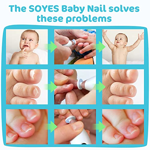 Soyes Newborn Nail File,Electric Baby Nail Trimmer,Baby Nail Clippers With Light And 5 Grinding Pads,Trim Polish And Groom,Essential For Healthy Baby Nails #TOP6