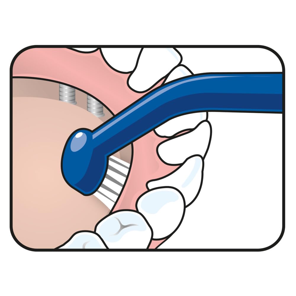 TEPE Implant Care Yumuşak Diş Fırçası