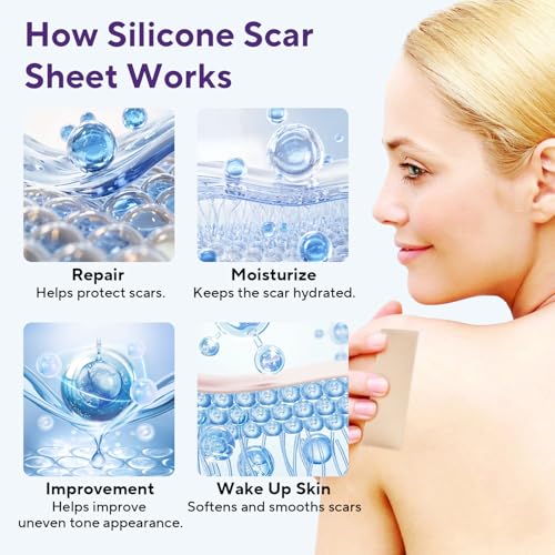 ZETRALL Silicone Scar Sheets, Silicone Scar Tape (1.6"x 60" Roll-1.5m), Advanced Scars Strips for Surgical, C-Section, Tummy Tuck, Burn, Hypertrophic, Keloid Bump Removal Treatment, Reusable — view 4