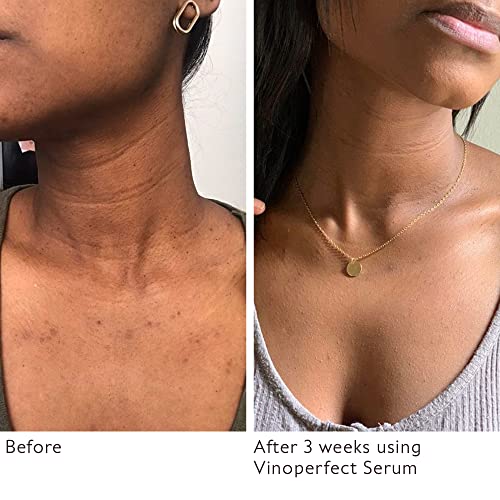 Caudalie Vinoperfect Radiance Dark Spot Serum - 62X More Effective Than Vitamin C (Serum) #TOP3
