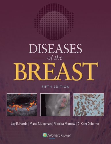 Amazon.com: Diseases of the Breast eBook : Harris, Jay R., Lippman ...