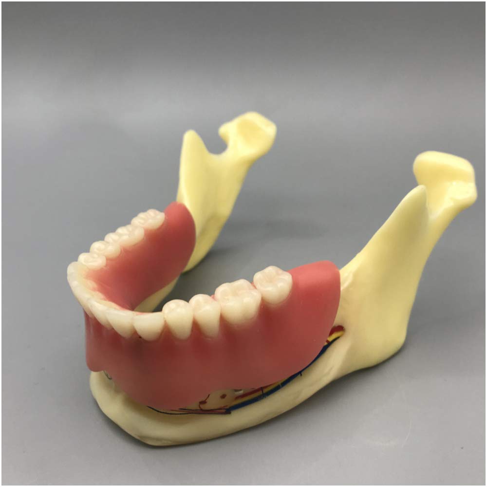 Sjdopulse A Mandible With Nerve Model - Dental Teeth Study Teaching Model - Denture Implant Nd Restoration Natomical Jaw Model - For Doctor-Patient Communication Explanation (A)