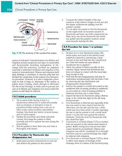 Clinical Procedures in Primary Eye Care, Expert