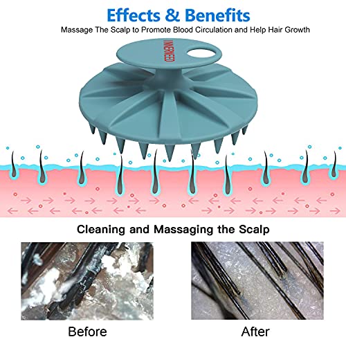 INNERNEED-Scalp-Massager-Shampoo-Brush-Wet-Dry-Manual-Scalp-Care-Head-Scrubber-Hair-Washing-Soft-Silicone-Bristles-for-Hair-Growth-Dandruff-Removal-Dark-Green