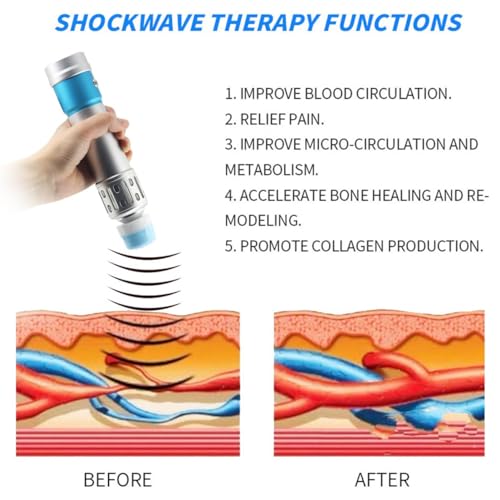 Shockwave Therapy Machine para tratamiento de ED - 10 cabezales para regeneración muscular y ósea, diseño compacto (36.5x37x17cm) - Solución efectiva de terapia por ondas de choque miniatura 5