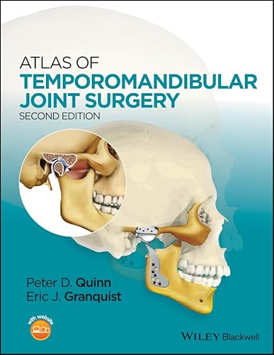 Atlas of Temporomandibular Joint Surgery