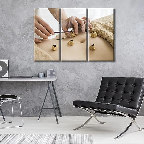 Image of Moxa Moxibustion Prints for Wall Decor Moxibustion Framed Wall Art Posters & Prints 3 Panels Nosocomium Paintings Giclee Print Gallery Packaging Artwork (36 inch Wx24 H)