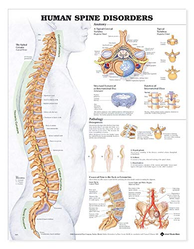 Anatomical Chart Company Human Spine Disorders Chart