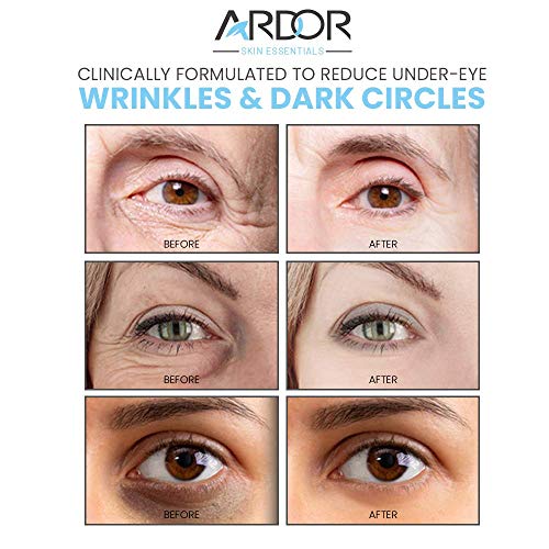 dark wrinkled skin under eyes