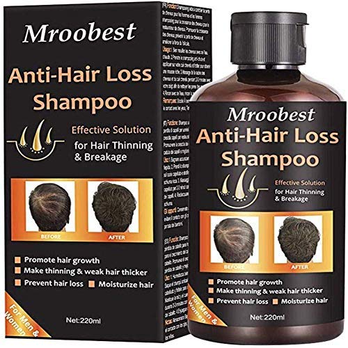 Anti-Hair Loss Shampoo, Hair Regrowth Shampoo, Natural Old Ginger Hair Care Shampoo Effective Solution for Hair Thinning & Breakage - Organic Hair Regrowth.Products for Men & Women