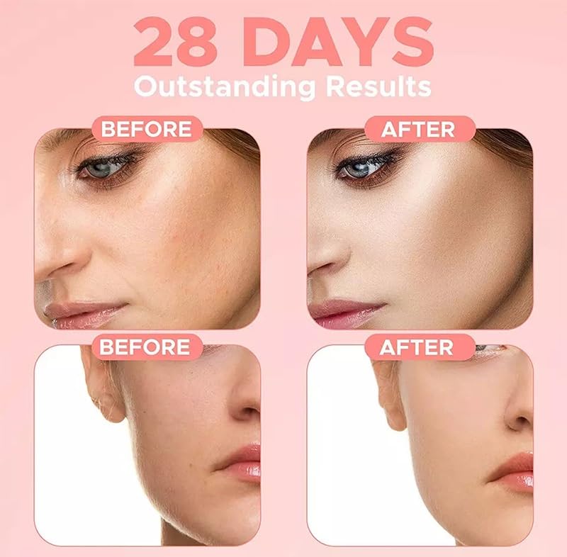 Miniatura 2 de Suero facial 4 en 1, 10% ácido hialurónico, 5% niacinamida, 30% vitamina C, 10% vitamina E, 1.01 fl oz