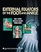 External Fixators of the Foot and Ankle