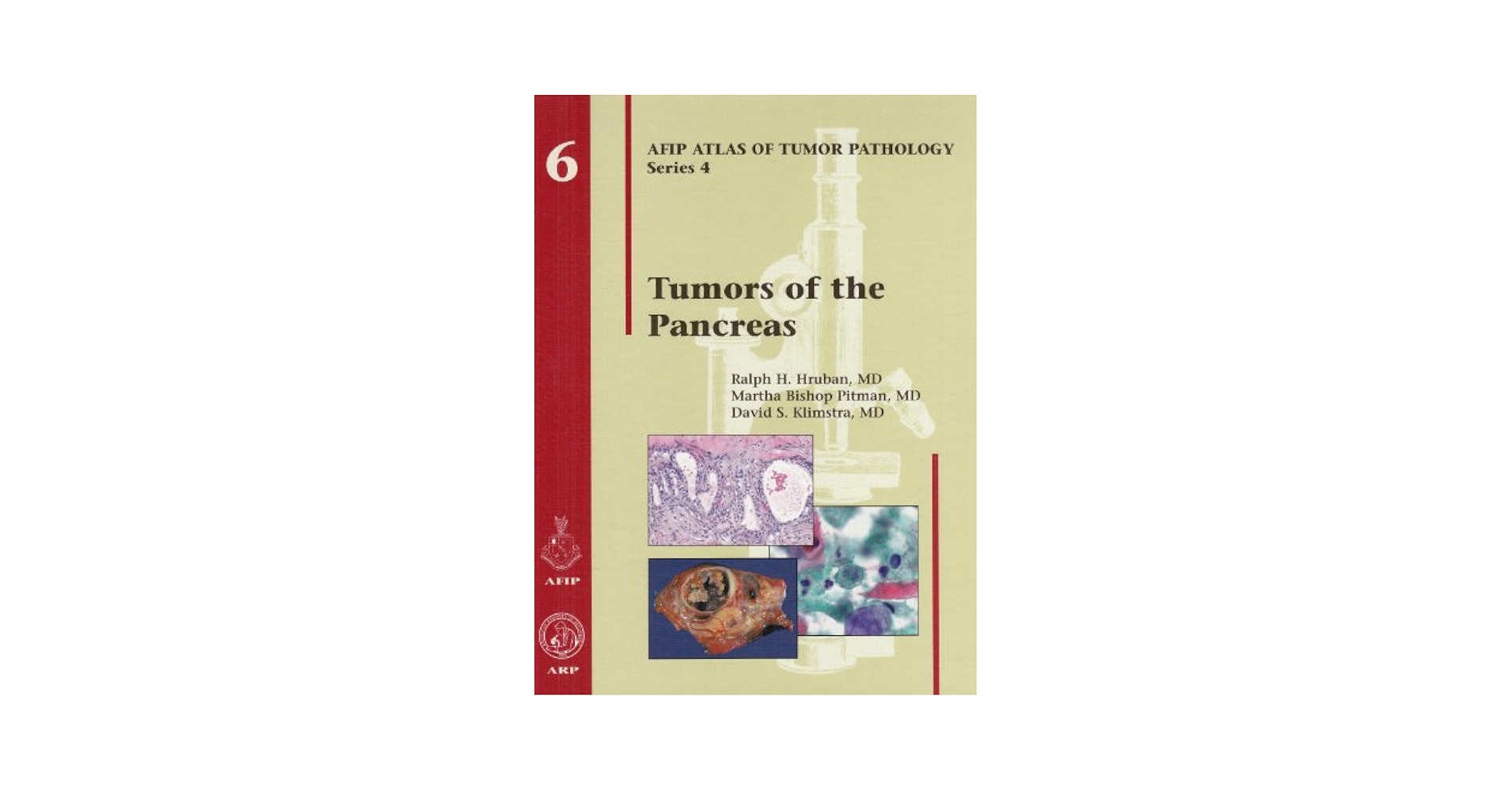 AFIP　Tumors of the Pancreas 【新品】 Tumors of the Pancreas (AFIP Atlases of Tumor and Non-Tumor