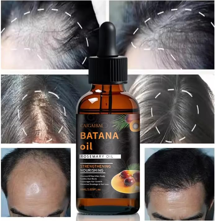 Batana Oil for Hair Growth with Rosemary Oil, 60ml, 2.02 Fl Oz