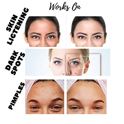 Image of Ayurvedic Kumkumadi Tailam Oil for Skin Whitening, Pigmentation (All Skin) 15ml