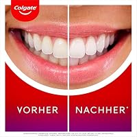 Colgate Max White LED Whitening Kit + Colgate Max White Overnight Whitening-Serum 2.5ml – Ansicht 3