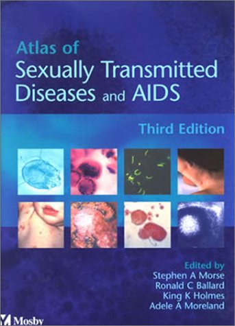 Atlas of Sexually Transmitted Diseases and AIDS: Expert Consult: Peter ...