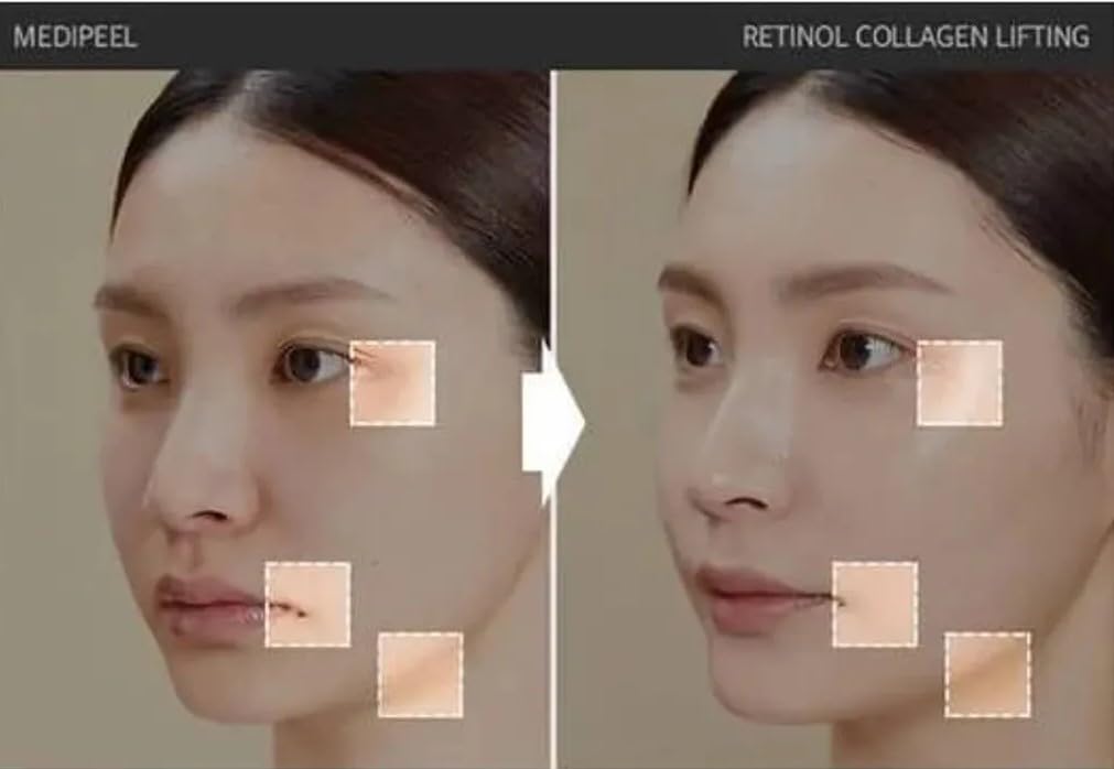 Ampoule Medi-Peel Rétinol Collagen Lifting – Soin Jour/nuit Visage Et Cou, 6 Mois D'utilisation