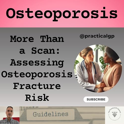 Podcast - Osteoporosis: Assessing Fracture Risk