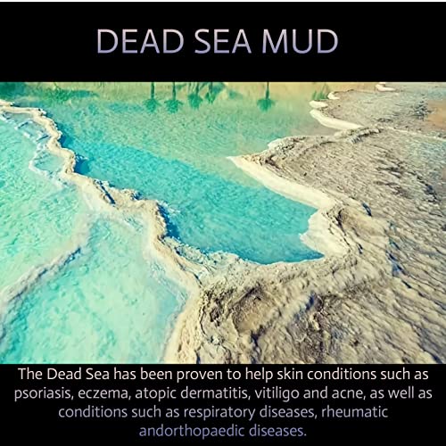 Vigderma Dead Sea Mud Mask For Face And Body - Spa Quality Pore Minimizer For Acne, Beauty Face And Skin, Natural Skincare For Women, Men - Tightens Skin, Facial Skin Care Face Mask - 8.8 Oz #TOP1