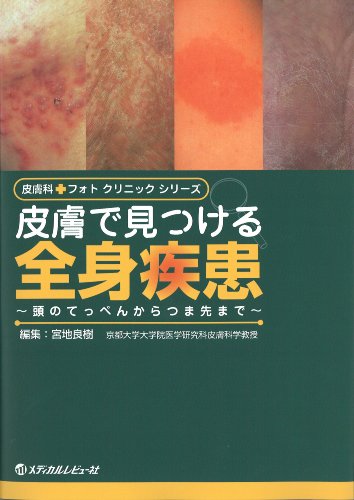 スマホ 無料電子書籍 皮膚で見つける全身疾患 (皮膚科フォトクリニックシリーズ) バイ