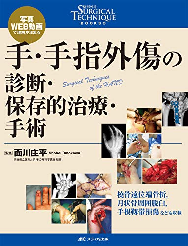 PDFダウンロード 手・手指外傷の診断・保存的治療・手術: 写真・WEB動画で理解が深まる (整 バイ