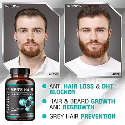 Hair Growth Vitamins For Men + Hair Growth Vitamins For Women.