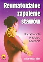 Reumatoidalne zapalenie stawow 8387777838 Book Cover