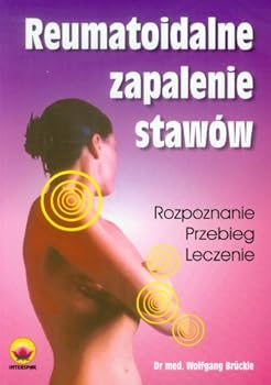 Paperback Reumatoidalne zapalenie stawow [Polish] Book
