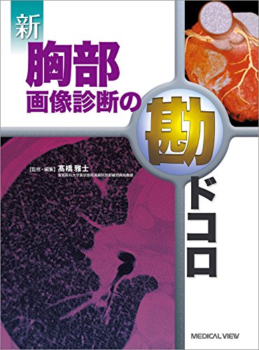無料電子書籍 pdf 新 胸部画像診断の勘ドコロ バイ
