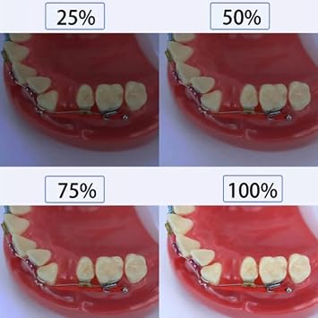Dentistry Photography Light Professional Fill Light Aid Colorimetric Photo Video Flashlight for Dental(Size:MK-016+37mm CPL)