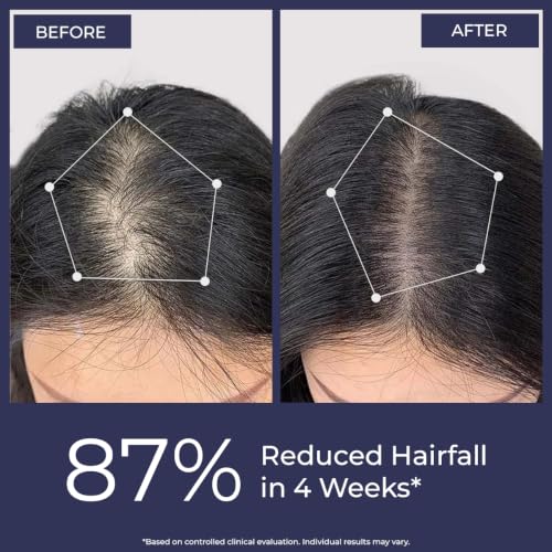 Image of Conscious Chemist Hair Growth & Anti Hair Fall Serum | Hairgenyl, 3% Redensyl, 2% Anagain, 2% Procapil, 2% Biotin & Saw palmetto | Controls Hairfall & 95% Saw New Hair Growth | Improves Hair Density | For Men & Women | 30ml