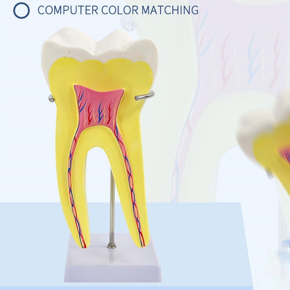 Modèle D'anatomie Modèle De Dents Molaires pour L'étude des Maladies Modèle De Dents Modèle De Dent Humaine