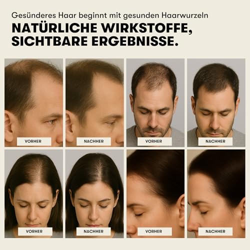 O.C. HAIRCARE Serum na porost włosów na noc - Serum do włosów przeciw wypadaniu | z rozmarynem, pantenolem i aloesem | Wspomaga porost włosów i zdrową skórę głowy | 100 ml