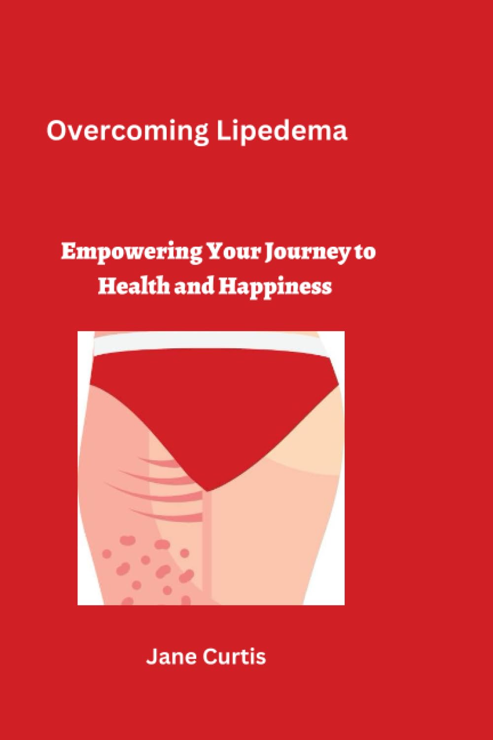 Overcoming Lipedema: Empowering Your Journey to Health and Happiness
