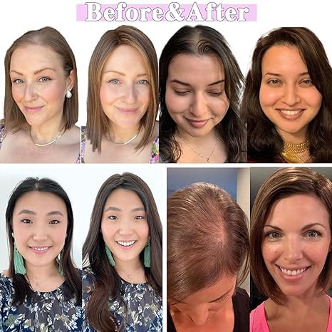 Lagomance Hair Toppers with Thinninghair 100% Real Human Hair Topper for Women 10inch Medium Brown Mix Blonde with Dark Brown Root Toppers 120% Density top toppee for ThinningHair4T427 - Image 4